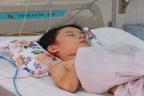 Bị ong vò vẽ đốt tới tấp, hai học sinh nguy kịch