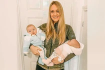 Cặp song sinh hiếm gặp, được mệnh danh là ‘siêu thai’