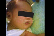 Rúng động y tá dán băng dính cấm bé 5 ngày tuổi khóc