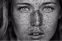 Hình ảnh tuyệt đẹp về khuôn mặt có tàn nhang