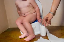 Mẹo chăm trẻ không bị lồi rốn