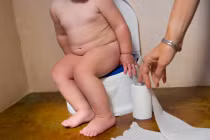 Mẹo chăm trẻ không bị lồi rốn