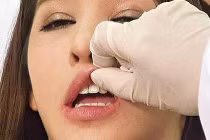 Cận cảnh kỹ thuật bơm môi, cấy mỡ làm đẹp