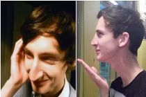 Chàng trai sửa mũi thành trai đẹp để tìm việc tốt 