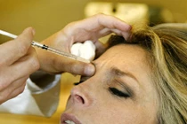 Rủi ro tiềm ẩn khi rút mỡ đùi bơm trẻ hóa mặt, tay