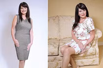 Bà lão chi gần 1 tỷ “dao kéo” thành thiếu nữ