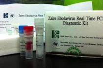 Phát hiện sớm vi rút Ebola với dụng cụ nhỏ gọn