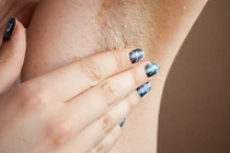 Tuyệt chiêu trị da thâm vùng nách tại nhà