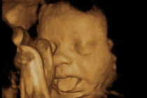 Khoảnh khắc thai nhi siêu cute