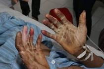 Điểm mặt những bệnh chết người từ món ăn tái sống