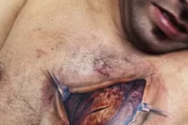 Rùng mình những hình xăm 3D xé rách toạc cơ thể