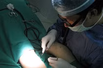 Cận cảnh kỹ thuật thẩm mỹ thu gọn bắp chân