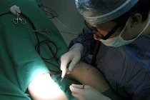 Cận cảnh kỹ thuật thẩm mỹ thu gọn bắp chân