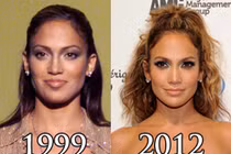 Điểm mặt sao thế giới đổi đời nhờ dao kéo