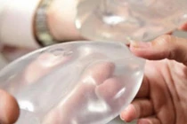 Những cái chết lãng xẹt vì bơm silicon làm đẹp