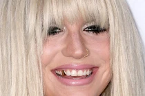 Những kiểu làm đẹp răng quái dị