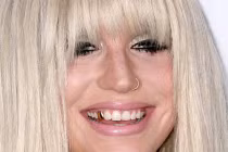 Những kiểu làm đẹp răng quái dị