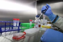 Vắc xin Ebola an toàn trong giai đoạn thử nghiệm đầu tiên