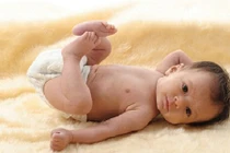 Dấu hiệu nhận biết sớm trẻ bị còi xương