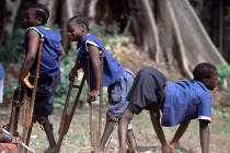 Virus gây bệnh bại liệt nguy hiểm như thế nào?