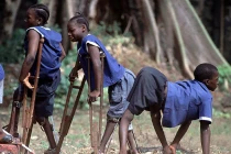 Virus gây bệnh bại liệt nguy hiểm như thế nào?