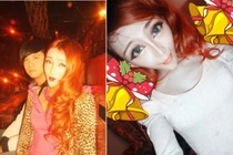 Những cô nàng ham dao kéo gọt cằm nhọn hoắt