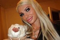 Bàng hoàng gái trẻ bơm môi kinh dị như mỏ vịt