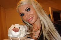 Bàng hoàng gái trẻ bơm môi kinh dị như mỏ vịt