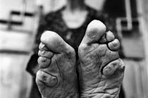 Ký ức hãi hùng của nhân chứng tục bó chân Trung Quốc