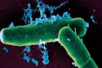 Rùng mình xem vi khuẩn bệnh Than tấn công cơ thể người