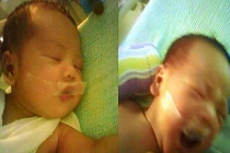 Thắt lòng những em bé bị y tá dán băng dính vào miệng