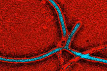 Thở cũng có thể nhiễm vi rút Ebola?