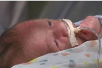 Kỳ lạ những bà mẹ đẻ rơi mới biết mình mang thai