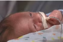 Kỳ lạ những bà mẹ đẻ rơi mới biết mình mang thai