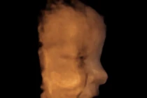 Ngỡ ngàng hình ảnh bé cười trong bụng mẹ