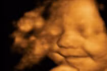 Ngộ nghĩnh nụ cười của thai nhi và em bé mới sinh