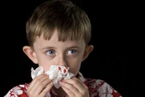 Điểm mặt thủ phạm khiến trẻ bị chảy máu cam