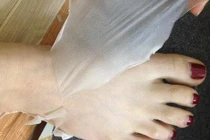 Nguy hiểm chết người từ tắm trắng da 