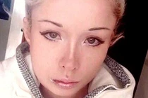 Bị đánh trọng thương vì phẫu thuật thẩm mỹ giống búp bê