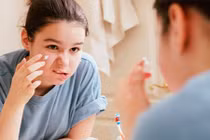 Sai lầm khi dùng thuốc trị mụn dễ để lại sẹo