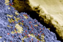 Soi cận cảnh vi khuẩn, mảng bám trên răng