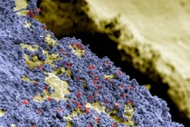 Soi cận cảnh vi khuẩn, mảng bám trên răng