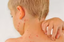 Tác hại không ngờ khi trẻ ăn quá nhiều đồ ngọt