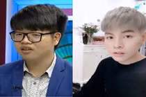 Sốc: Đức Phúc phẫu thuật thẩm mỹ đẹp như trai Hàn