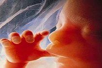 Bào thai hóa thạch 50 năm trong bụng bà cụ 90 tuổi