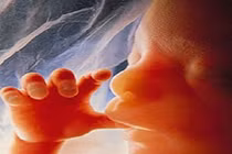 Bào thai hóa thạch 50 năm trong bụng bà cụ 90 tuổi