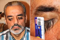 Bí ẩn loại thực phẩm khiến lông mi dài hơn 3 cm