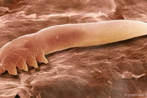 Cận cảnh ký sinh trùng giống đỉa sống trên da mặt người