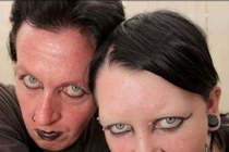 10 căn bệnh ma quái gây kinh sợ nhất lịch sử y học