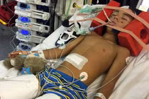 Cậu bé được cứu sống nhờ cấy hộp sọ vào dạ dày